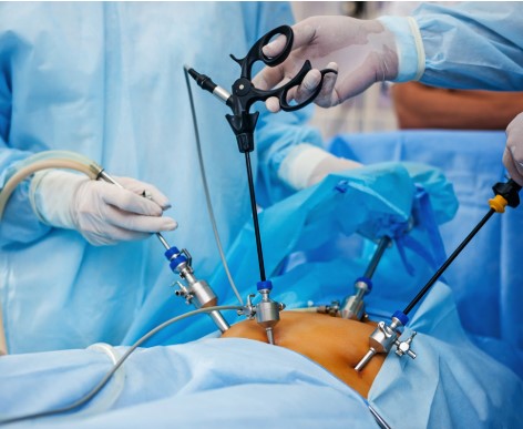 Gastro Surgeon in Ahmedabad